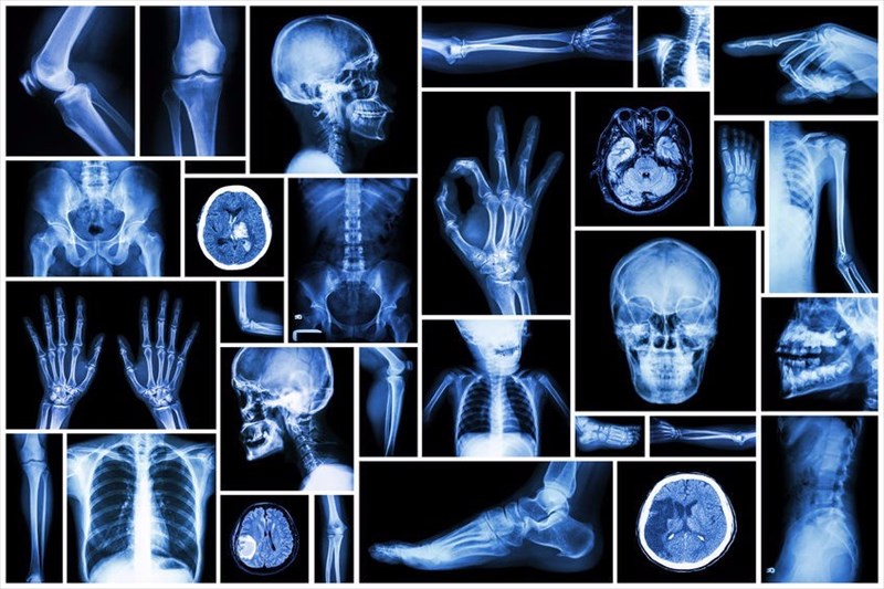x-ray film